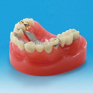 Dental Restoration / Prothesis Study Model [PE-PRO002]