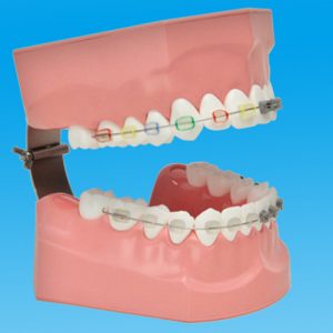 Tooth Brushing Demonstration Model [PE-ORT002]