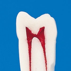 Endodontic Tooth Model [A12A-200]