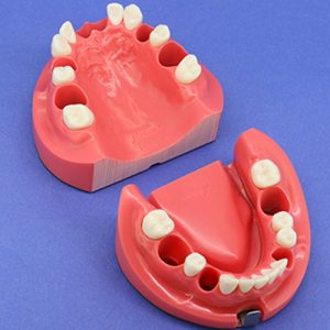 Electrical Root Canal Length Measurement Training Model Jaw [CON1001 Series]