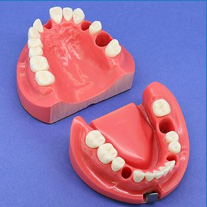 Electrical Root Canal Length Measurement Training Model Jaw [CON1002 Series]