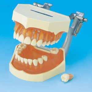 Study Model With Removable Teeth [PE-ANA001]