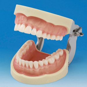 Prosthetic Restoration Jaw Model (32 teeth) [PRO2001-UL-SCP-FEM-32]