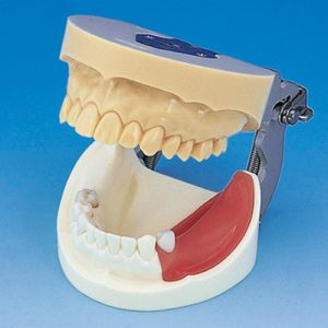 Implant Practice Jaw Model [IMP1001-UL-SP-FEM]